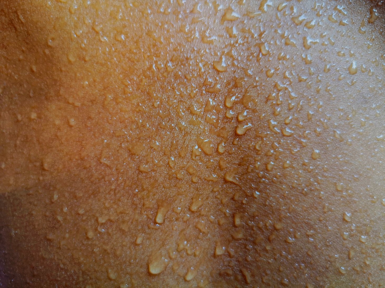 Water drops at the skin